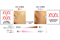 肌のメラニン、コラーゲンの量に影響を及ぼすDNA修復酵素を発見 ~美肌に重要なDNA修復酵素『NEIL1』~