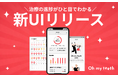 【新UIリリース】“終わりが見えない”矯正からの脱却｜Oh my teeth、治療の進捗がひと目でわかる新UIを提供開始
