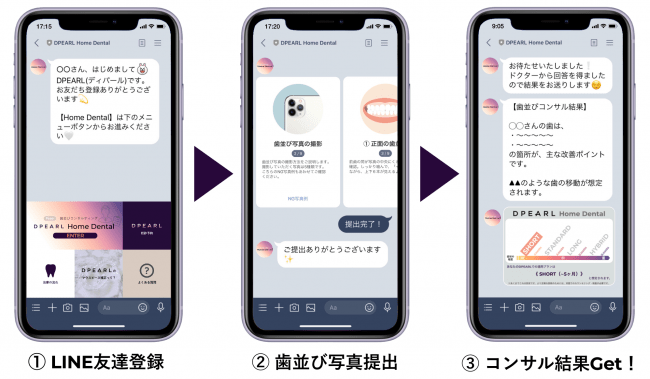 DPEARL Home Dentalの流れ