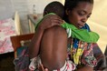 エムポックスは子どもたちにとって命に関わる深刻なリスク。国際NGOワールド・ビジョンが警鐘