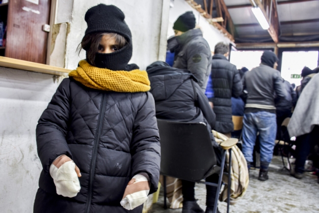 氷点下10度の気温の中、家族と移動してきた少女。 ベオグラードの支援拠点に着いた時、少女の両手は凍傷になっていた。