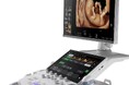 GEヘルスケア・ジャパン 産婦人科向け超音波画像診断装置「Voluson Performance 18」を販売開始