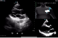 GEヘルスケア・ジャパン、超音波診断装置「Vscan」シリーズにAI機能を初搭載した「Vscan Air SL Ally」を販売開始