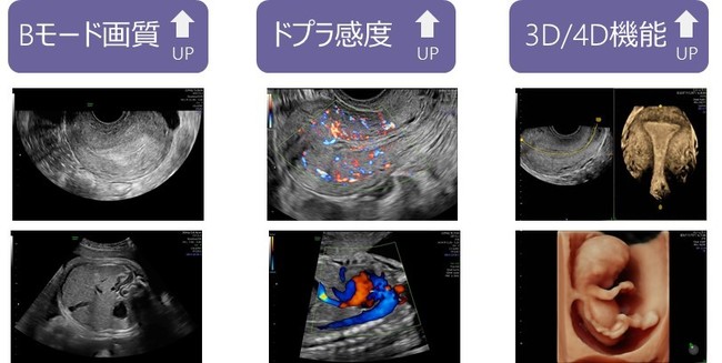 GEヘルスケア・ジャパン、産婦人科向け超音波画像診断装置「Voluson 