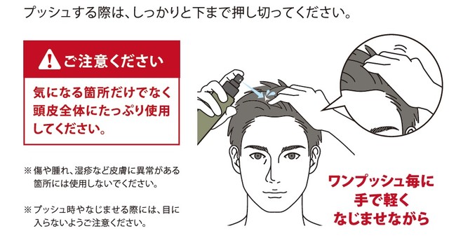 日本で唯一＊¹の薬用発毛促進剤が誕生 トリプルケアで徹底的に