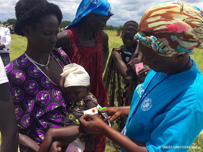 栄養不良の検査を受ける子ども。 (2017年8月撮影) (C) UNICEF_UN0120044_Makundi
