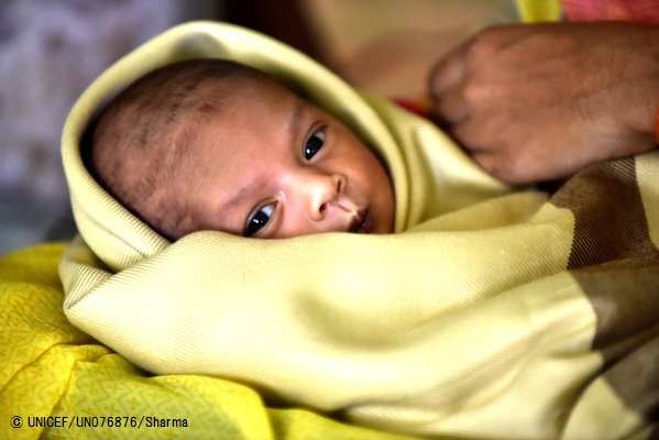 生後10カ月の女の子。(インド)2017年7月撮影© UNICEF_UN076876_Sharma