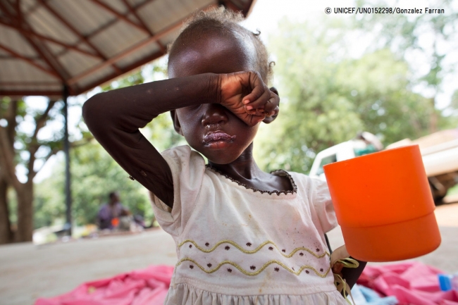 重度の急性栄養不良と診断され、治療ミルクを飲む2歳のマリア・ジョンちゃん。 (2017年10月撮影) © UNICEF_UN0152298_Gonzalez Farran