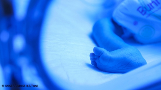 治療を受ける未熟児の赤ちゃん。 (2018年1月8日撮影) © UNICEF_UN0156165_Fuad