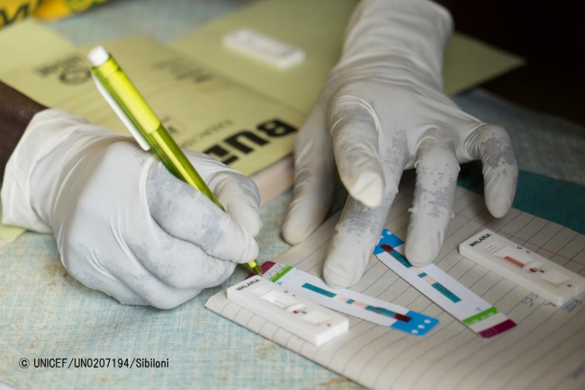 採取した血液で、HIV検査がおこなわれる（ウガンダ）(C) UNICEF_UN0207194_Sibiloni