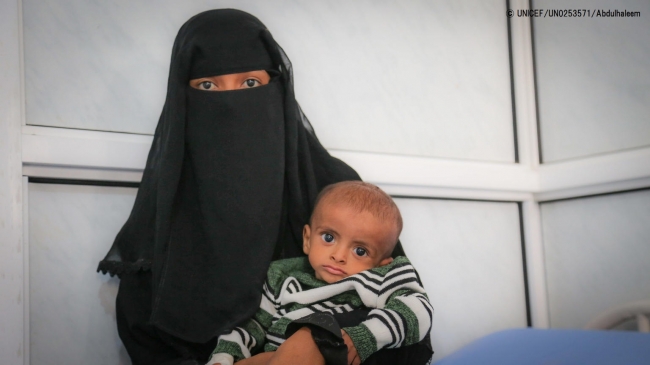 重度の急性栄養不良に苦しむ子どもたちが治療を受けるサウラ（al-Thawra）病院。(2018年10月31日撮影) (C) UNICEF_UN0253571_Abdulhaleem