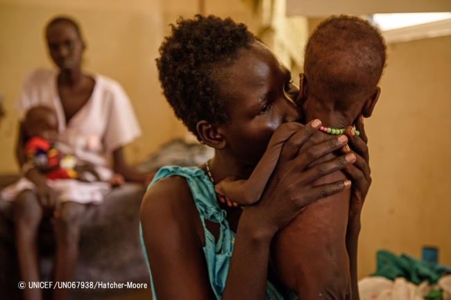 ベンティウにある病院で、重度の急性栄養不良の治療を受けている1歳の息子を抱く母親。© UNICEF_UN067938_Hatcher-Moore