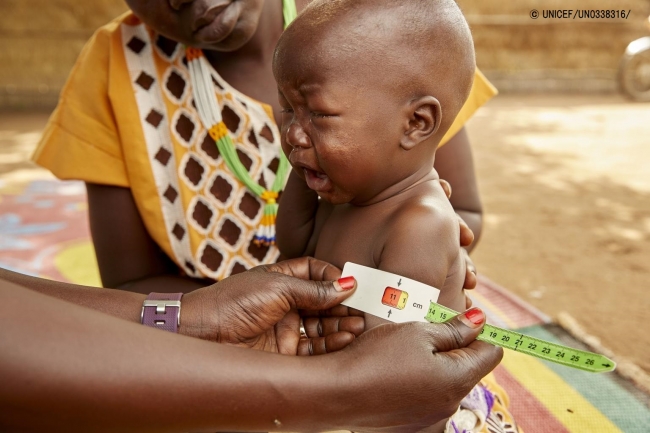 上腕計測メジャーを使って栄養不良の検査を受ける生後8カ月の赤ちゃん。(2019年7月19日撮影) © UNICEF_UN0338316_