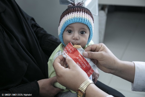 サヌアの病院ですぐに食べられる栄養治療食(RUTF)を口にする生後7カ月のモヘブちゃん。(イエメン、2020年2月5日撮影) © UNICEF_UNI312535_Alghabri