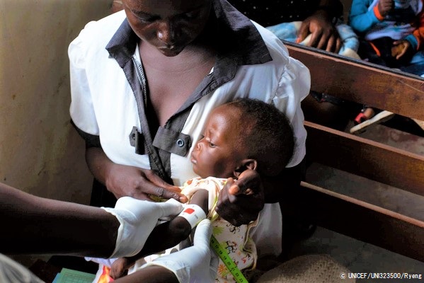ジュバのプライマリ・ヘルスケア・センターで、上腕計測メジャーを使って栄養不良の検査を受けるファリダちゃん。(南スーダン、2020年4月20日撮影) © UNICEF_UNI323500_Ryeng