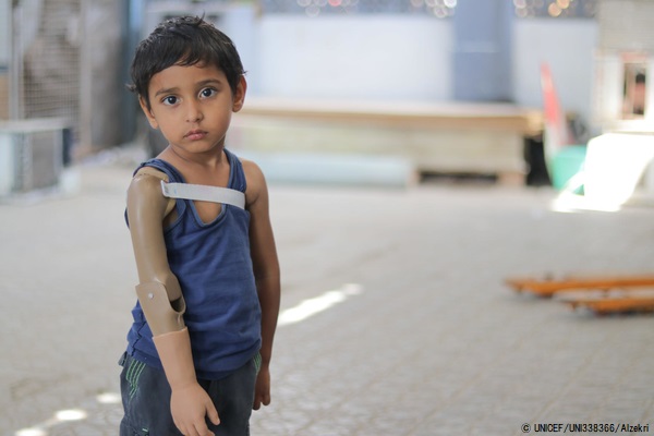 紛争が激化したアデンで、一年前に片腕を失った3歳のライアンちゃん。 (2020年2月6日撮影) © UNICEF_UNI338366_Alzekri