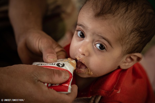 マアリブにある国内避難民キャンプで、すぐに食べられる栄養治療食(RUTF)を口にする1歳のアルワちゃん。(2020年3月12日撮影) © UNICEF_UNI337484_