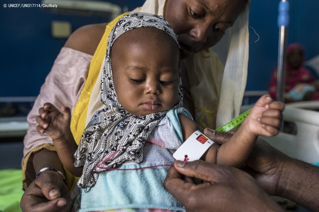 栄養不良の検査を受けるため、母親に連れられて自宅から135km離れたトンブクトゥの病院にやって来た1歳のマヤちゃん。(マリ、2020年3月撮影) © UNICEF_UNI317114_Coulibaly
