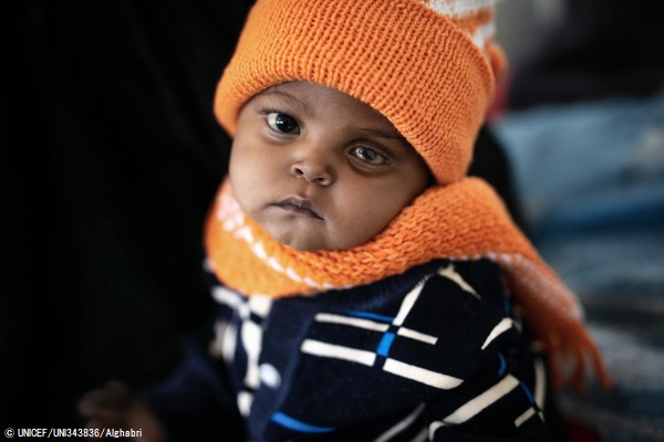 サヌアの病院で体重測定を受ける1歳のマゼンちゃん。(2020年2月撮影) © UNICEF_UNI343836_Alghabri