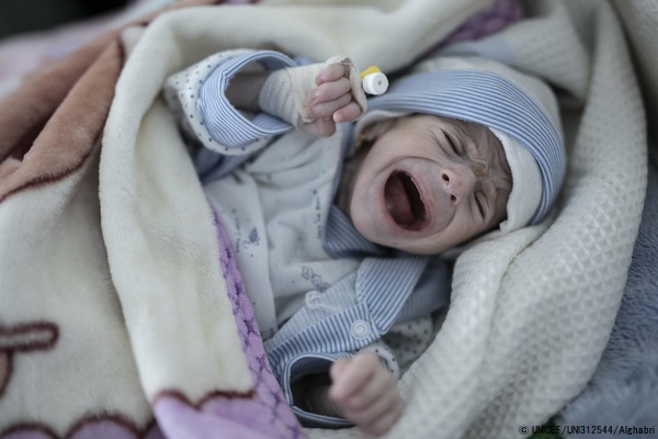 重度の栄養不良にかかり、サヌアの病院で治療を受ける生後4カ月のシュアイブちゃん。(イエメン、2020年2月撮影) © UNICEF_UNI312544_Alghabri
