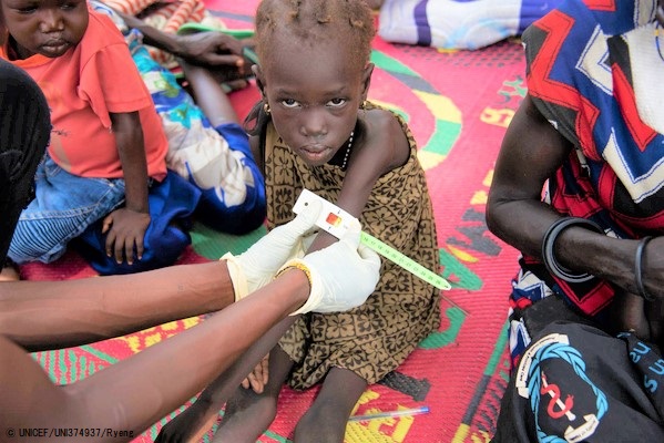 ピボールにある栄養センターで上腕計測メジャーによる栄養不良の検査を受ける4歳のカタリンちゃん。(南スーダン、2020年9月撮影) © UNICEF_UNI374937_Ryeng