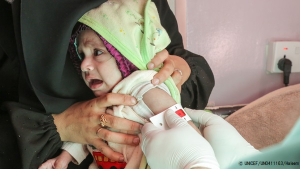 上腕計測メジャーによる栄養不良の検査を受ける生後7カ月のラワビちゃん。(2020年12月撮影) © UNICEF_UN0411163_Haleem