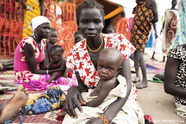 ピボールにある栄養クリニックで診察を受ける、急性栄養不良の生後8カ月のチャチャちゃん。(南スーダン、2020年9月撮影) © UNICE_UNI374933_Ryeng