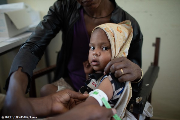 ティグライ州の保健センターで、上腕計測メジャーを使って栄養不良の検査を受ける子ども。(2021年4月撮影) © UNICEF_UN0445189_Ayene