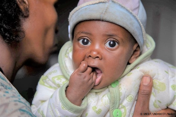 ティグライ州南部で行われたユニセフの栄養状態チェックで、重度の栄養不良と診断され、すぐに食べられる栄養治療食(RUTF)を受け取った生後6カ月の赤ちゃん。(2021年7月20日撮影) © UNICEF_UN0494131_Nesbitt