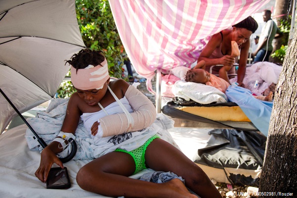 レカイの病院で骨折した腕の手術を待つ6歳のペティオッテくん。(2021年8月15日撮影) © UNICEF_UN0502981_Rouzier