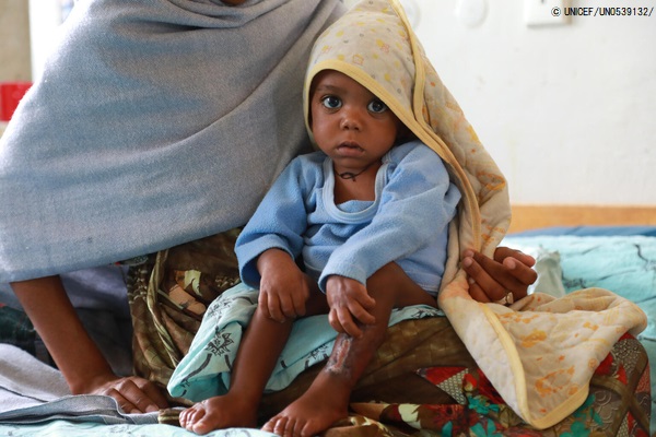 ユニセフが支援するティグライ州都メケレにある病院で、重度の栄養不良の赤ちゃんの回復を見守る母親。(エチオピア、2021年10月撮影) © UNICEF_UN0539132_