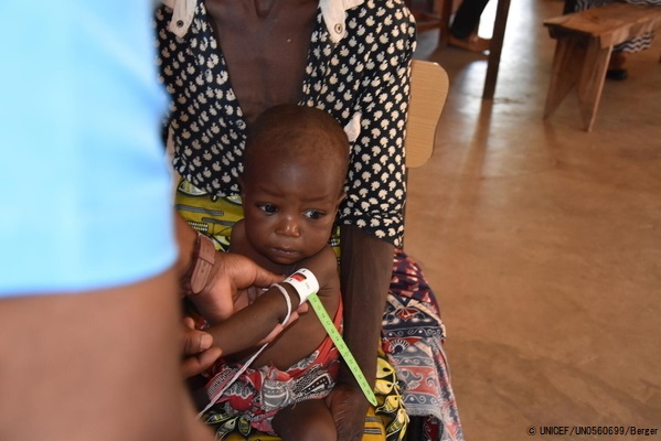 腕周りの太さを測り、順調に育っているかどうかを診る上腕計測メジャーを腕に巻かれた子ども。「赤色」は、重度の栄養不良を示す。(マラウイ、2021年11月3日撮影) © UNICEF_UN0560699_Berger