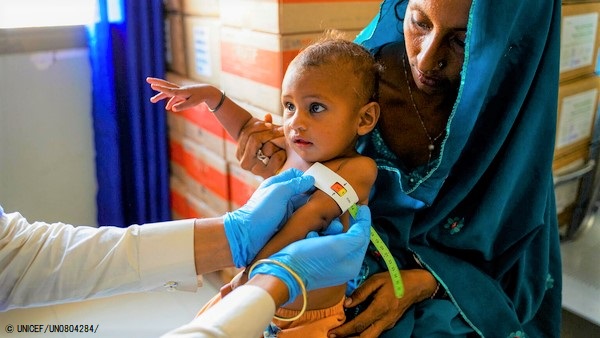上腕計測メジャーを使った栄養検査で「赤色」となり、「重度の栄養不良」と診断された子ども。(2023年2月27日撮影) (C) UNICEF_UN0804284_