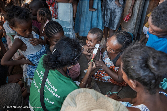 アツィモ・アンドレファナ県の遠隔地にある村を訪れたユニセフが支援する移動式栄養クリニックで、上腕計測メジャーを使った栄養検査を受け、重度の栄養不良と診断された2歳のミチンジュちゃん。(マダガスカル、2023年3月撮影) (C) UNICEF_UN0845991