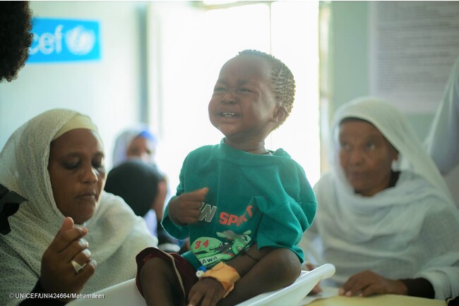 ワドメダニ病院で体重を測定し、栄養不良の検査を受ける子ども。(スーダン、2023年8月10日撮影) (C) UNICEF_UNI424664_Mohamdeen