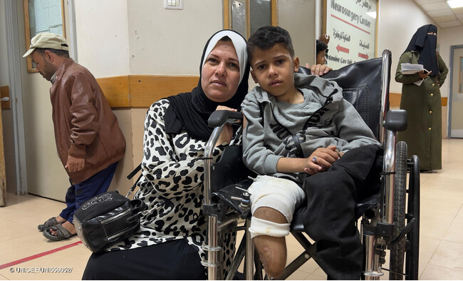 ハンユニセフの病院で、脚を切断し車いすに座る男の子。(ガザ地区、2024年4月8日撮影) (C) UNICEF_UNI556052_