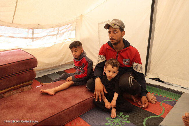 ラファにある避難所のテントの中で、父親と過ごす7歳のアミールさん(左)と2歳の従弟。母親はガザ北部にいるため離れ離れになっている。アミールさんは学校に避難したときに右脚を負傷し、あと数回の手術が必要な状態である。(ガザ地区、2024年4月14日撮影) (C)