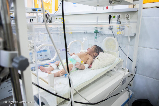 マリブにある病院の新生児集中治療室(NICU)で、治療を受ける赤ちゃん。(イエメン、2024年5月26日撮影) (C) UNICEF_UNI599965_Alhamdani