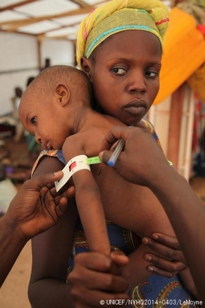 栄養状態の検査を受ける子ども。メジャーが赤色を示し、男の子は栄養不良状態であると診断された。© UNICEF/NYHQ2014-0403/LeMoyne