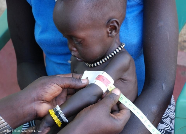 栄養状態の検査を受ける子ども　©UNICEF South Sudan/2014/Peru