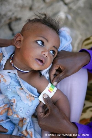 栄養状態の検査をする赤ちゃん（エリトリア）© UNICEF/NYHQ2008-1649/Pirozzi