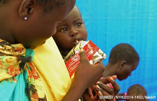 栄養不良の子どもに、すぐ口にできる栄養治療食を与える様子。© UNICEF/NYHQ2014-1403/Nesbitt