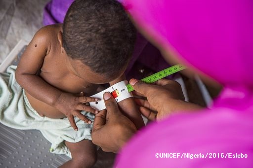 ボルノ州マイドゥグリ近くのミュナ・ガレージ国内避難民キャンプに設置されたユニセフが支援する栄養治療センターに、重度の栄養不良で搬送された2歳のアッシュちゃん。©UNICEF_Nigeria_2016_Andrew Esiebo