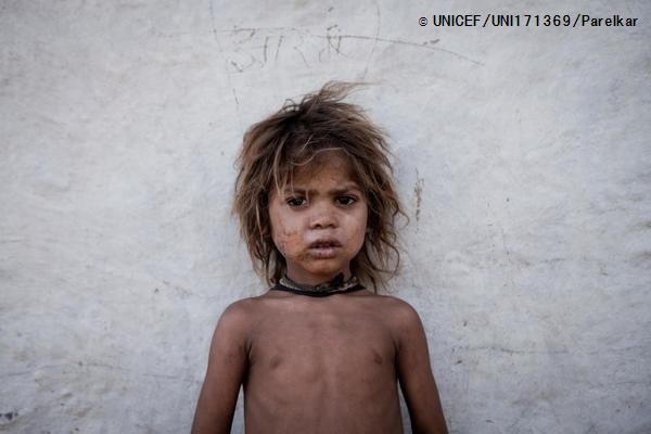 ビルケラ・ダーン村に住む、サハリア族のループシンちゃん（4歳）。（インド・ラージャスターン州　2014年5月30日撮影）© UNICEF_UNI171369_Parelkar