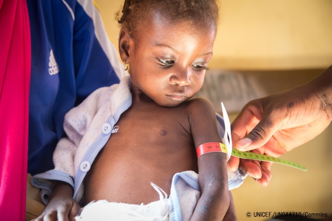 ナイジェリア・マイドゥグリの栄養治療センターで検査を受ける子ども（2016年12月撮影）© UNICEF_UN044710_Commins