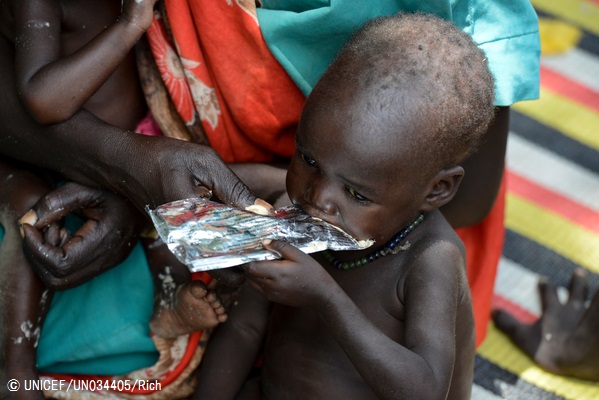 ユニセフが支援する外来治療センターで、すぐに食べられる栄養治療食(RUTF)を食べる子ども(南スーダン)2016年8月撮影© UNICEF_UN034405_Rich