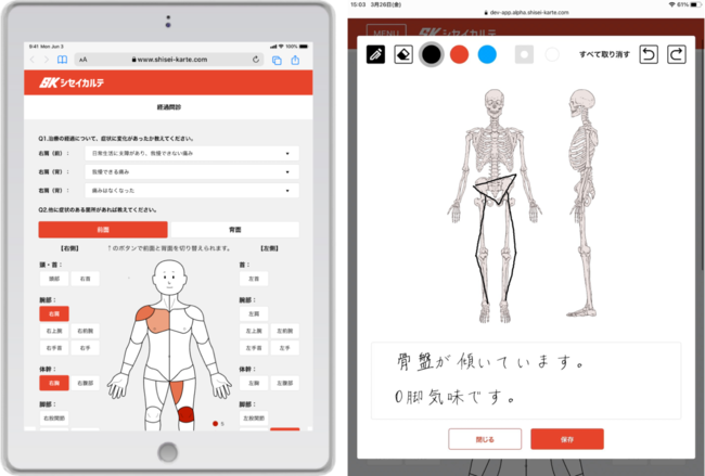 専門家のもと、AIによる姿勢分析を実施。理学療法士の先生からの指導が受けられます