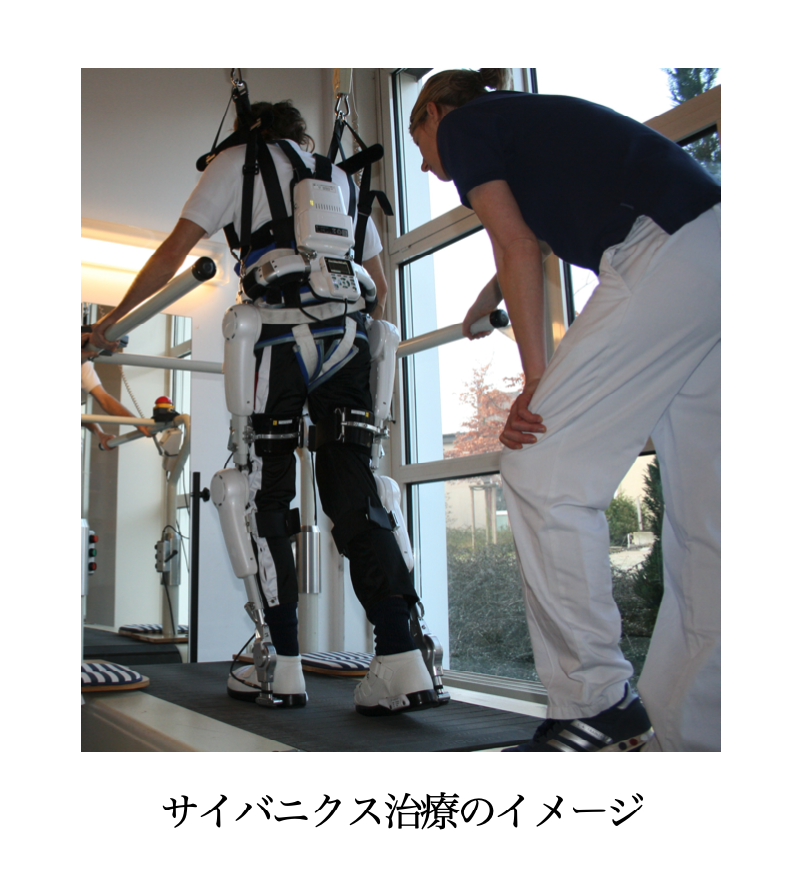 【ニュース】サイバニクス治療によるALS患者の歩行機能改善の有効性を示す論文公開