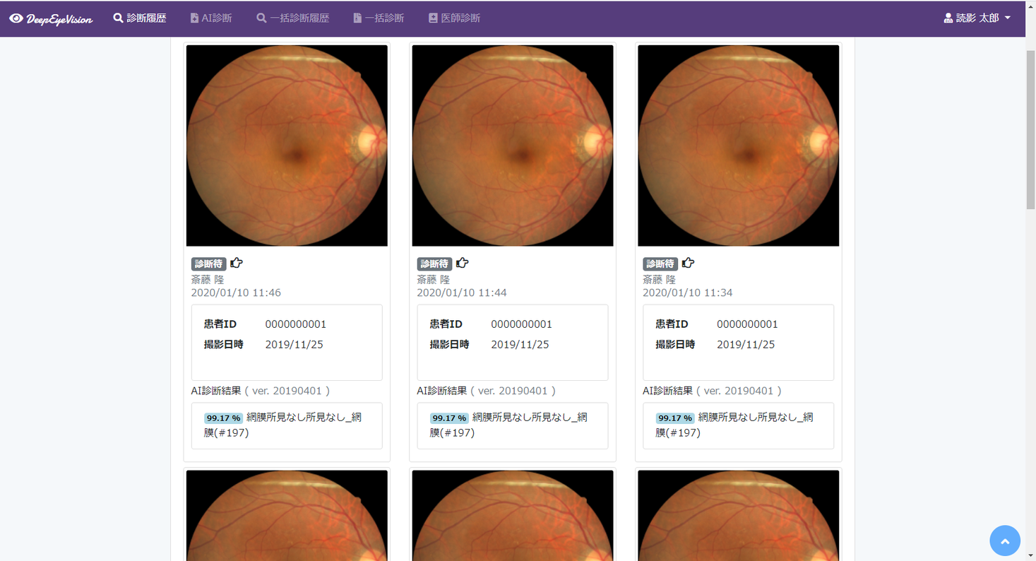 自治医大発ベンチャー「DeepEyeVision」、眼科向けAI診断支援ソリューションを提供開始