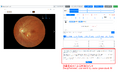 自治医科大学とDeepEyeVision、LMM(大規模マルチモーダルモデル)による眼底読影所見の自動生成機能を構築